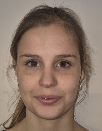 Profile picture of Rhune Krols