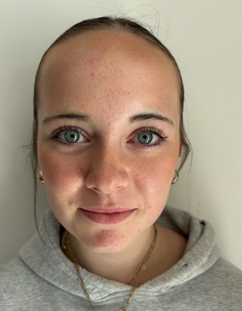Profile picture of Enora Ceenaeme