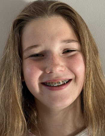 Profile picture of Ernaelsteen Zara