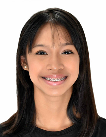 Profile picture of Esayem Zoie Abong