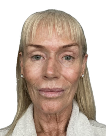 Profile picture of Aileen Carroll-Turner